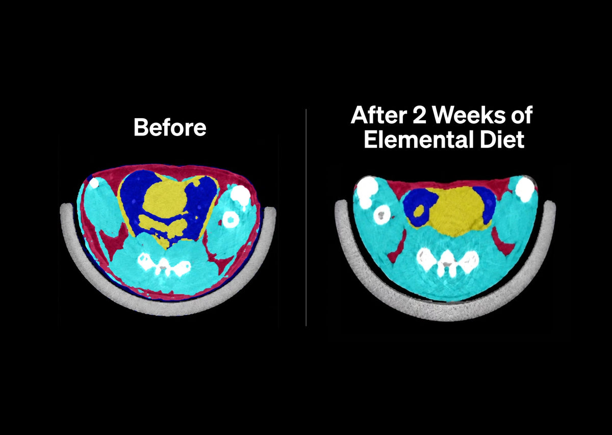 Research at UEG 2026 Explores Effects of mBIOTA Elemental Diet on Body Composition & Fat Loss