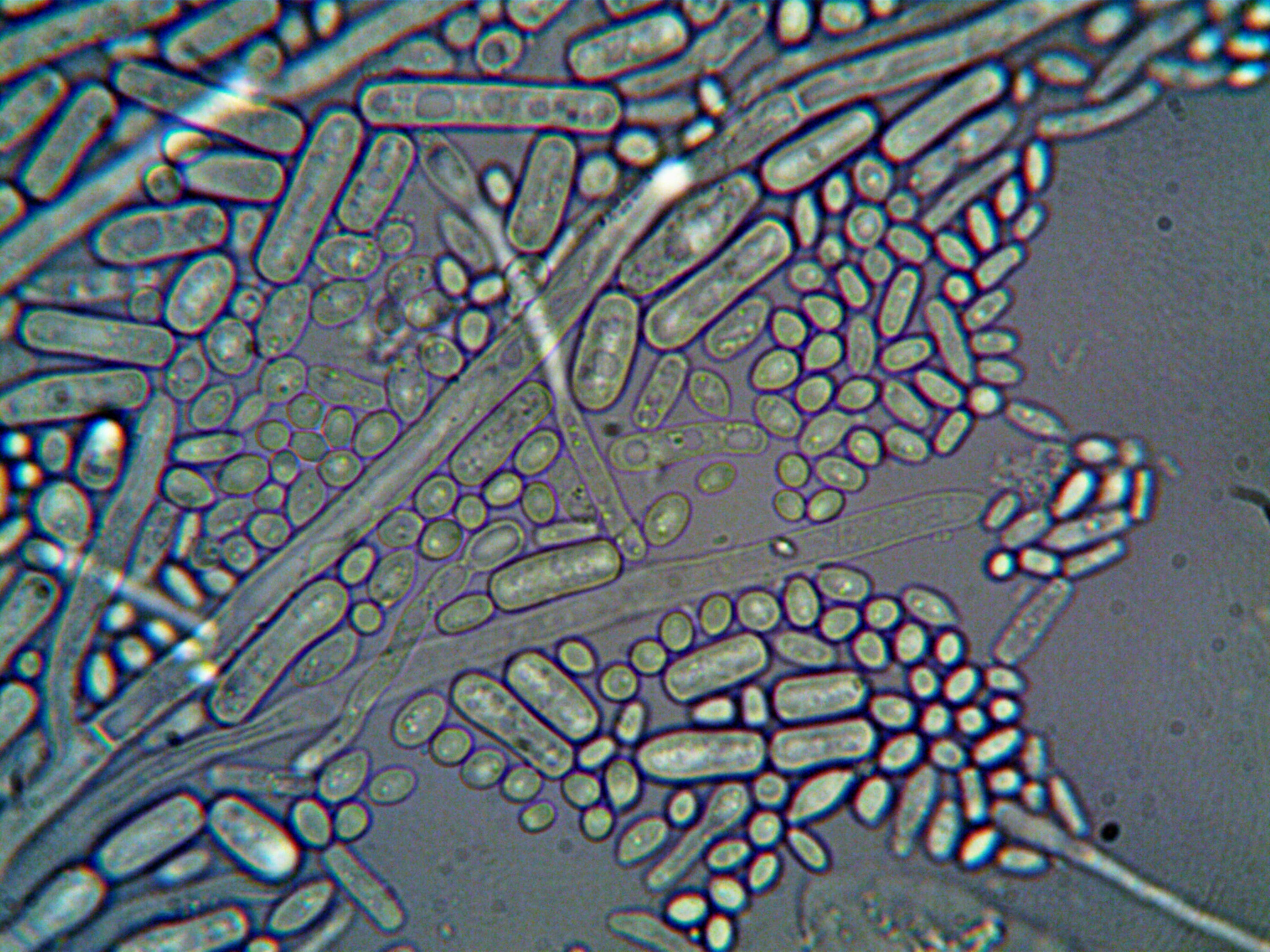 Effect, Tolerability, and Safety of Exclusive Palatable Elemental Diet in Patients With Intestinal Microbial Overgrowth
